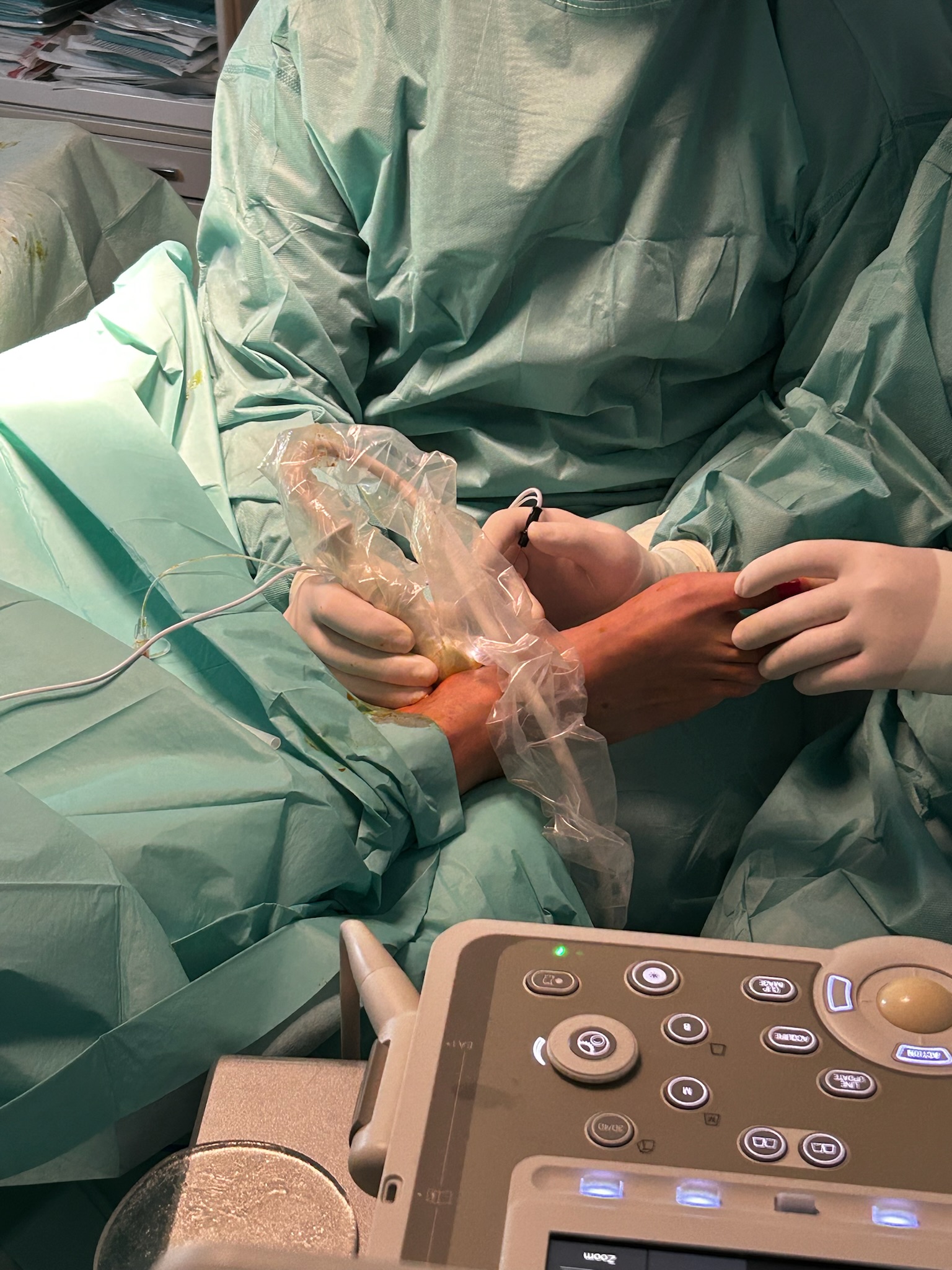 Ecografia musculoesquelética aplicada ao pé