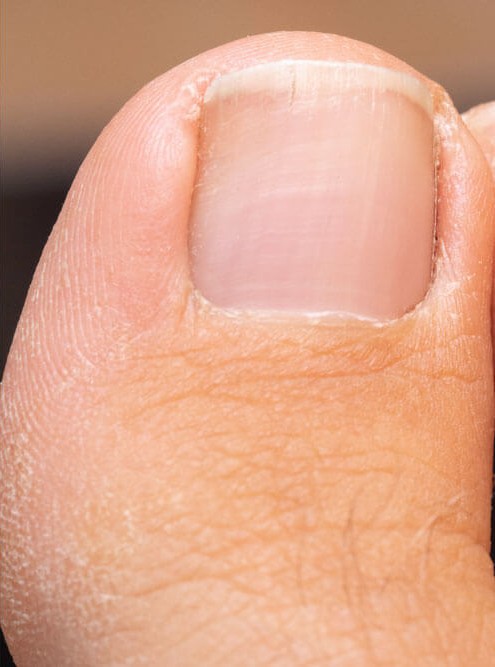 Depois do tratamento (exemplo)