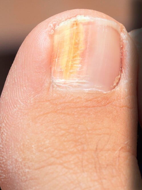 Antes do tratamento (exemplo)