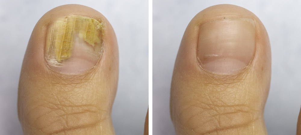 Imagem de apoio (ex.: detalhe de procedimento, fotografia macro)