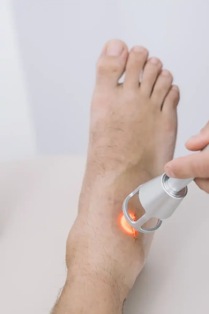 Equipamento de laserterapia (substituir pela sua fotografia)