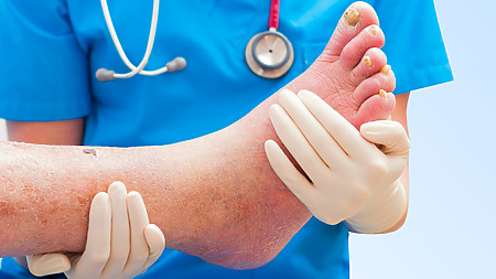 Pé diabético e geriátrico